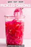 Quick pickled red onions pinterest image.